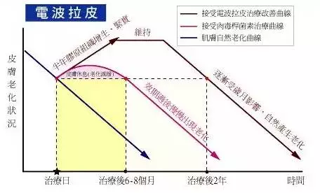 热拉提的原理_抗衰紧肤美容仪器好用吗 绿美涵 惠州抗衰紧肤美容仪器