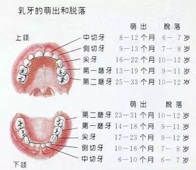 2,乳牙龋齿,恒牙也难逃—— 可能引发恒牙龋坏,恒牙排列不整齐