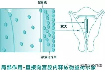 黄体酮是什么原理_黄体酮是什么(3)