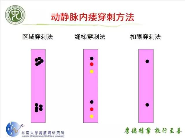 东南大学附属中大医院张留平护士长:动静脉内瘘不同穿刺方式的比较与