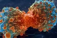 资料图 癌细胞 图片来源:中国日报网