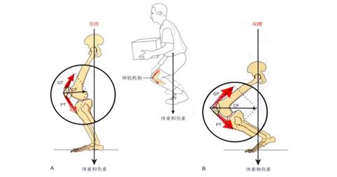 膝关节常见疼痛的运动康复