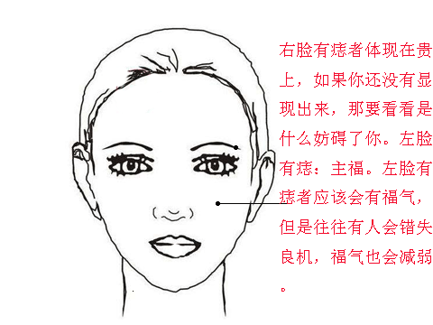 女人脸上的七大吉痣,你有几颗