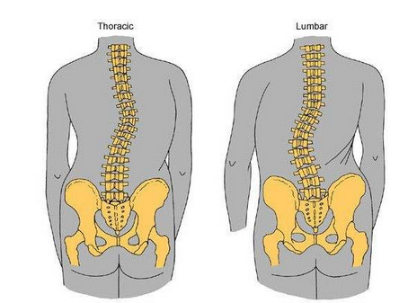 每个家长都该警惕"儿童脊柱侧弯"带来的危害!