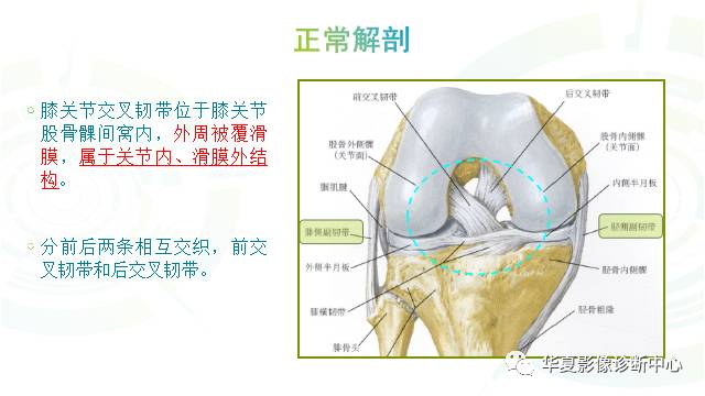 膝关节周围韧带解剖及mr表现. 来源 | 华夏影像诊断中心 责任编辑