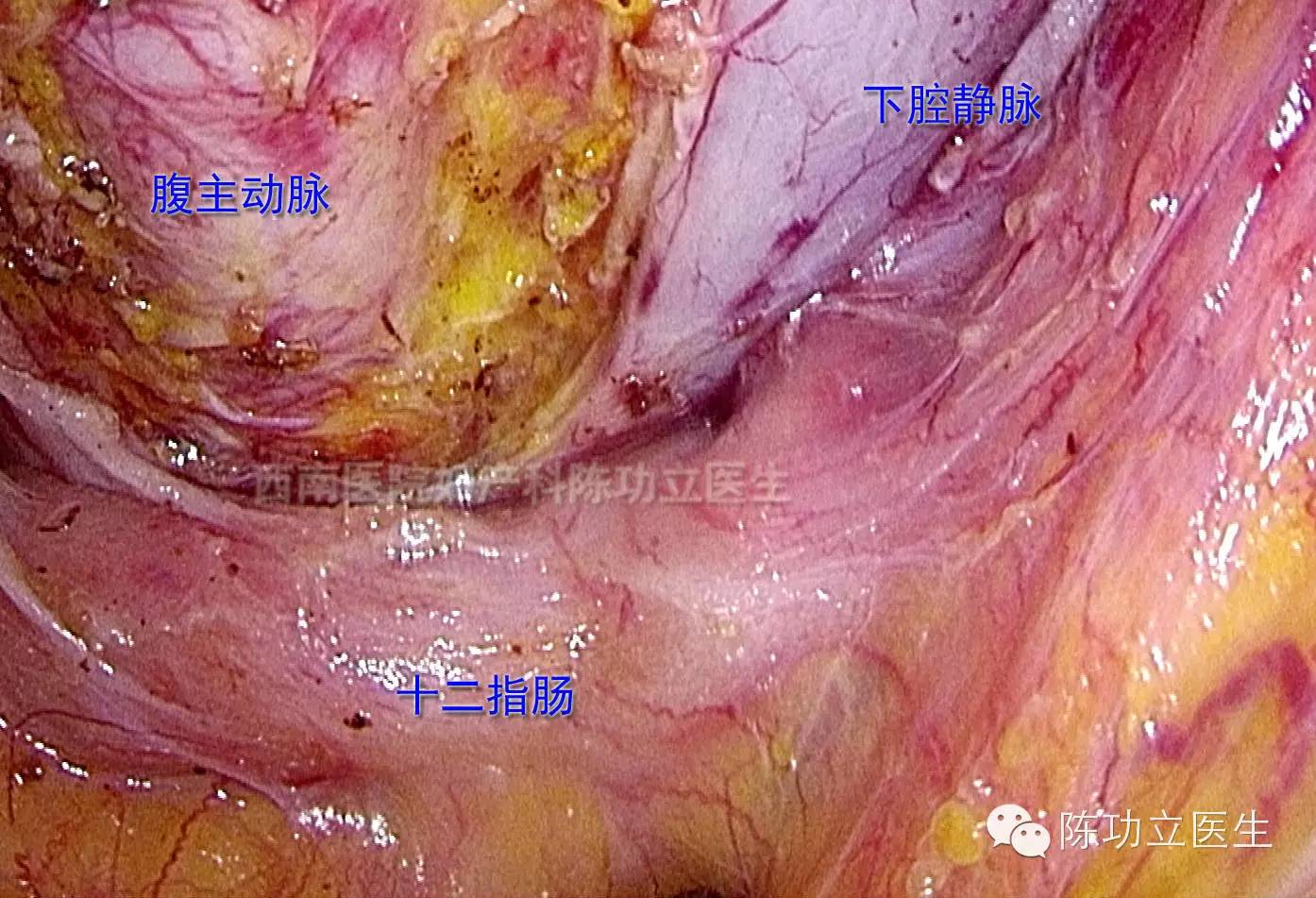 收藏妇产科手术解剖图谱之血管解剖