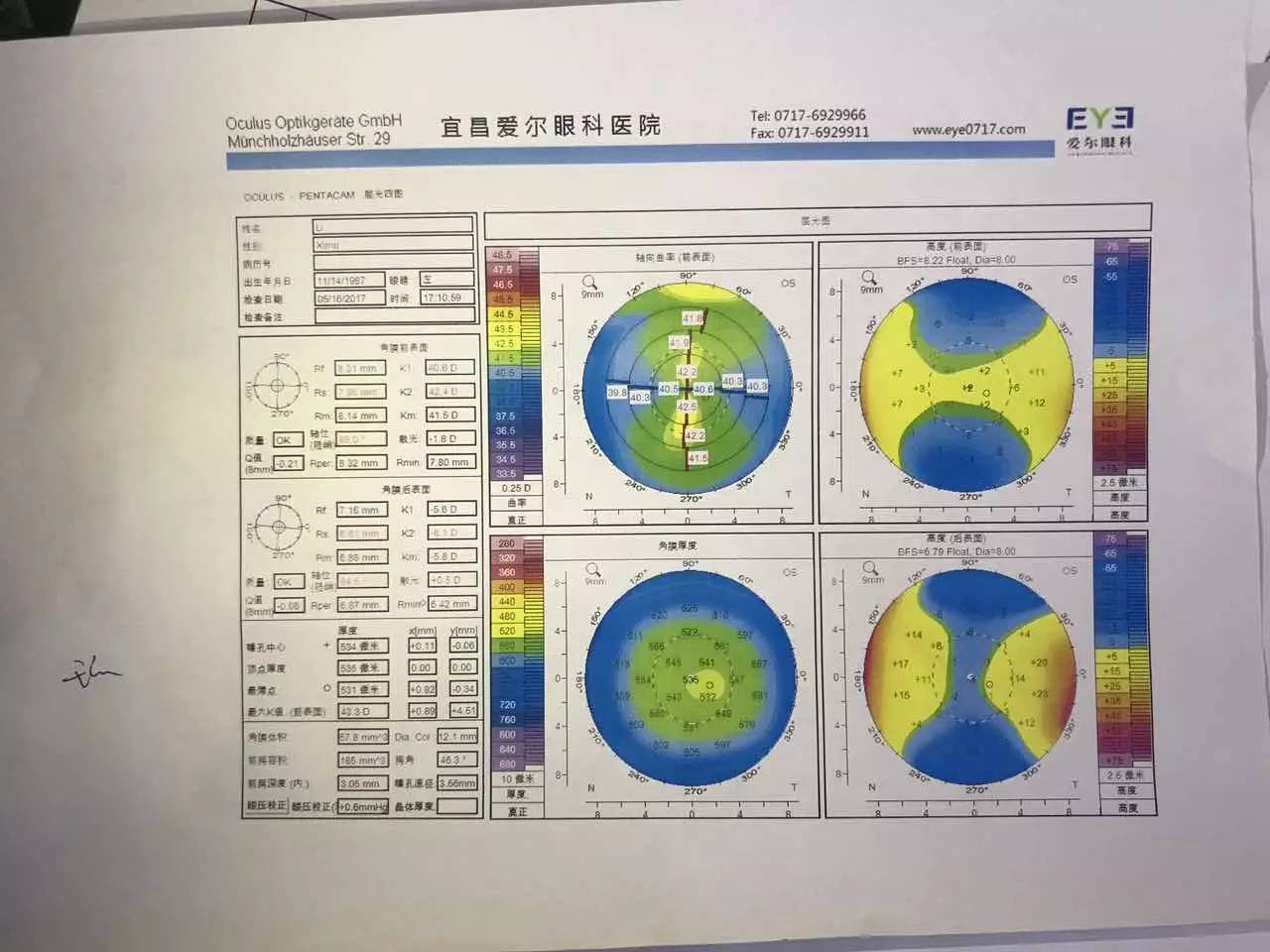 角膜地形图 角膜各项指标 正常