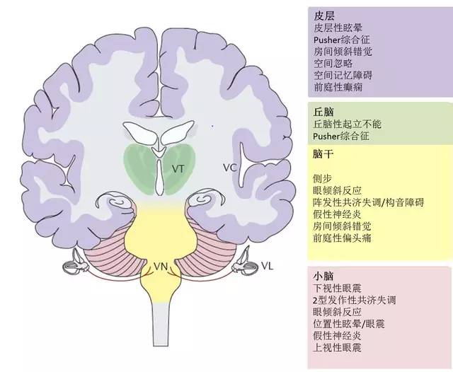 更高级前庭功能障碍的可能表现