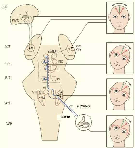 来自迷路和前庭神经的前庭传入信号通过同侧和对侧的内侧纵束上行,至