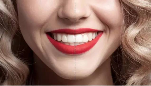 1 笑起来的嘴型呈半月形 2 3 4 看到了么 笑容的指标和牙齿息息相关!