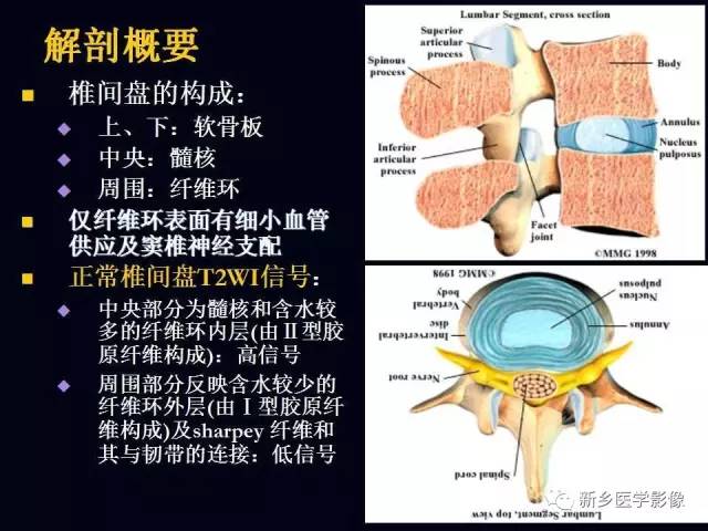 一文读懂椎间盘突出的解剖要点