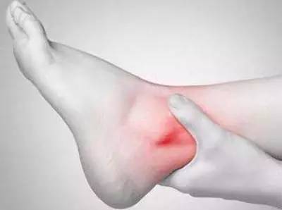 7,脚踝疼痛 走路习惯引起的肌肉不能灵活应用 灸疗法:灸法导引手法