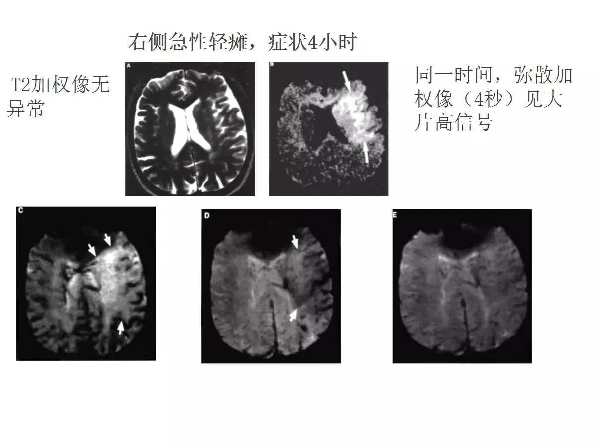 收藏头颅核磁共振几个成像的意义