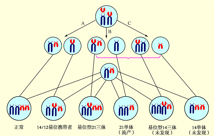 染色体平衡易位我还能怀孕吗