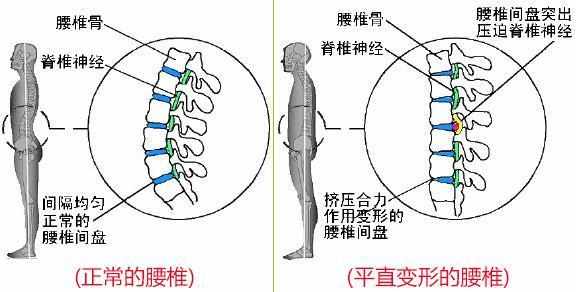 膏药的原理是什么_膏药的原理: 疏通经络的原理