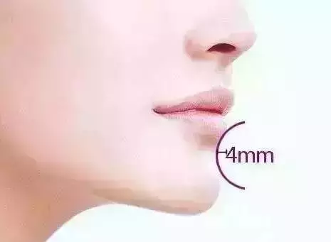 唇与下巴之间(即颏唇沟)有较明显的美学凹陷,标准颏唇沟深约4mm.