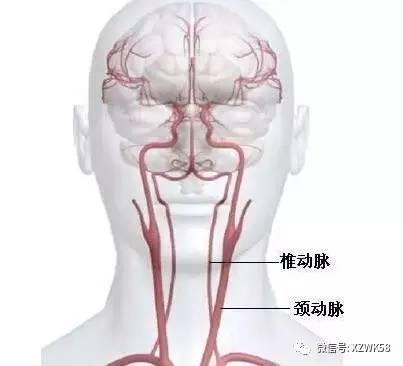 大脑里的血液是从颈动脉和椎动脉流过来的, 动脉占80%,椎动脉占20%.