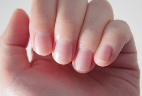 指甲盖怎么看缺不缺钙