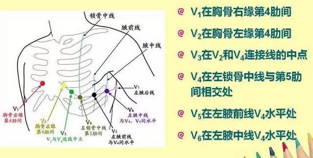 心电图各导联的位置