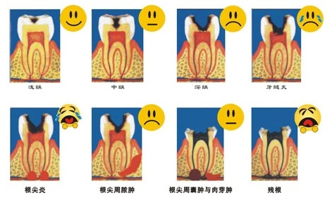 有獠牙怎么办