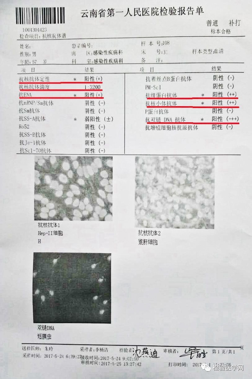 抗核抗体谱5w,3步走!