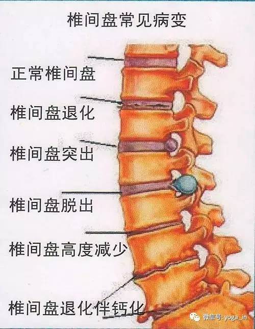 每天被腰椎间盘突出所折磨,这一个体式帮你解决病痛