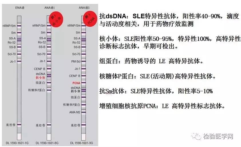 抗核抗体谱5w,3步走!