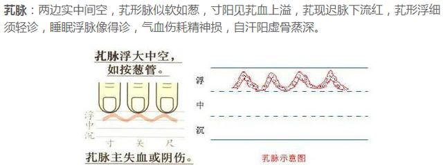 芤脉结脉疾脉缓脉滑脉洪脉革脉(私信bigu19)浮脉类浮脉伏脉短脉代脉