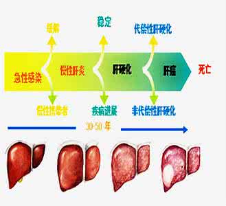 肝部硬化怎么办