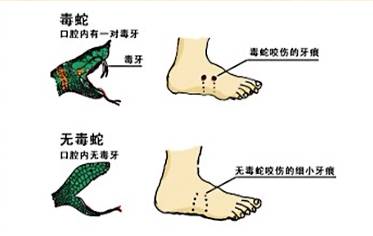 那么,被蛇咬伤后急救和自救非常关键一旦被