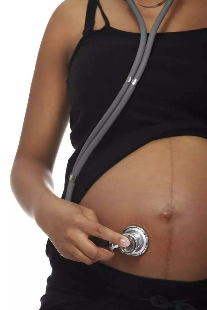 孕期准妈妈肚皮上那条黑线是什么?和男女有关吗?
