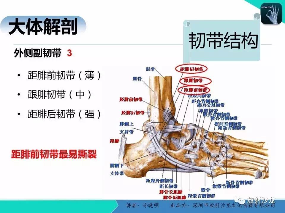 【专家大讲堂】基于损伤机制的踝关节急性损伤的影像