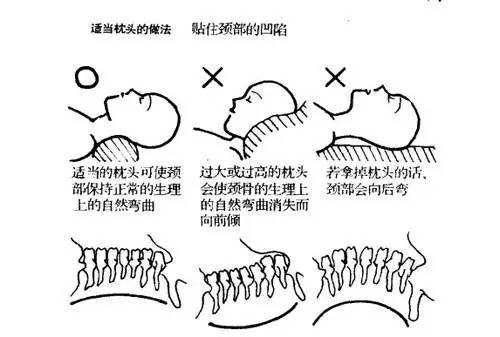 一个舒适,符合人体曲线和睡姿的枕头, 不仅能缓解颈椎病的苦恼, 还能