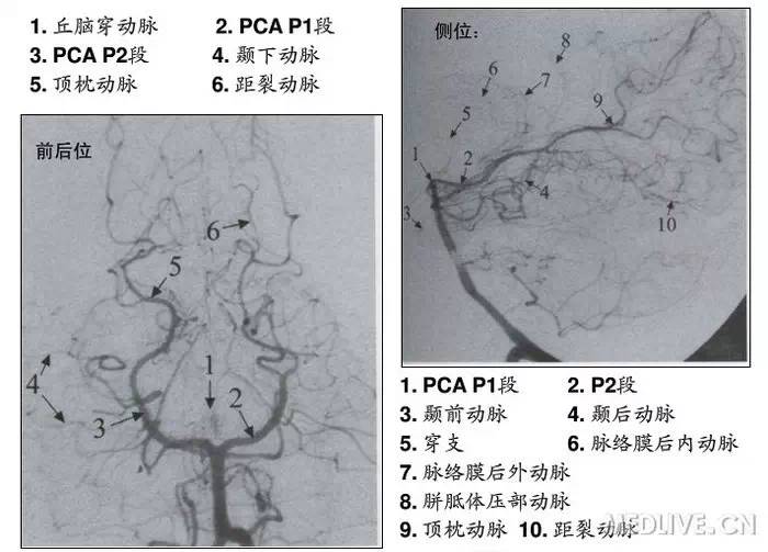 【神经科美图】图解脑供血系统之脑动脉