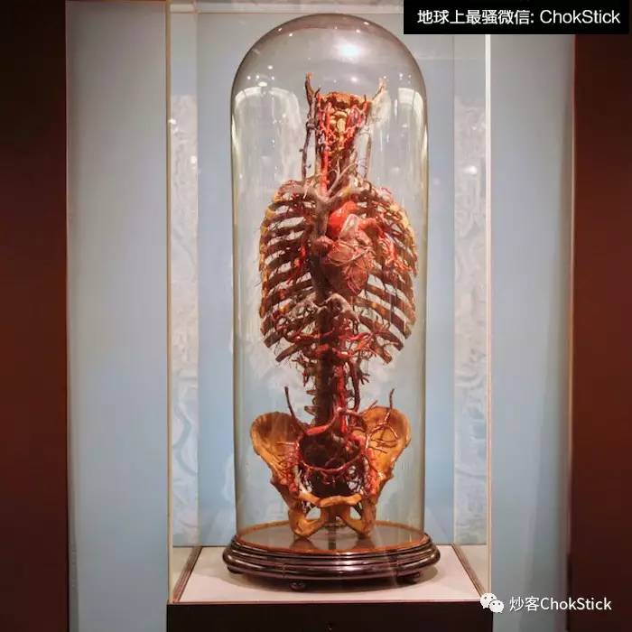 说到重口味天堂,谁能比得过医学教授开的人体器官博物馆?