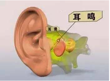 感音神经性耳聋伴有耳鸣,中医能够治好吗?