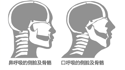 "张嘴睡觉不一定是张口呼吸呀!