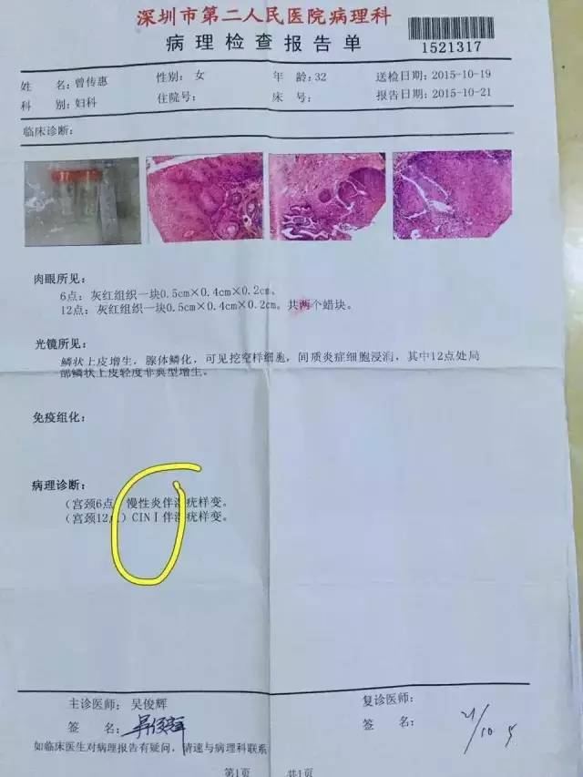 【案例分享】她患了宫颈癌四处求医,因为相信完美,最后完美也没有让她