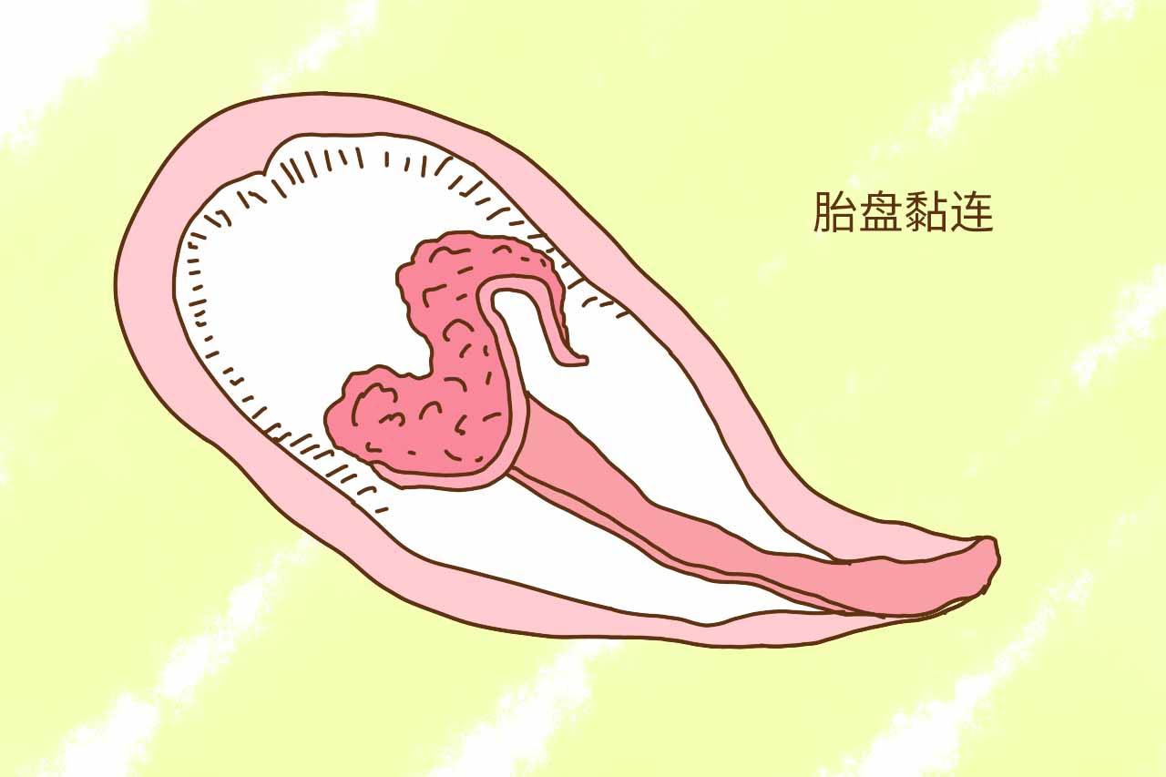 婴儿胎盘的功效与作用（新生儿的）-幼儿百科-魔术铺