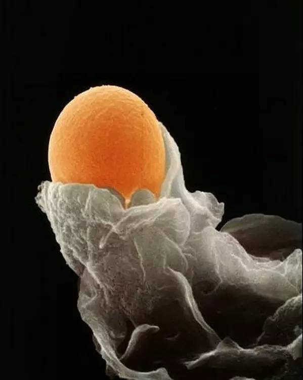 卵子经过大约15厘米长的,狭窄的输卵管向子宫游动,它周围的营养细胞像