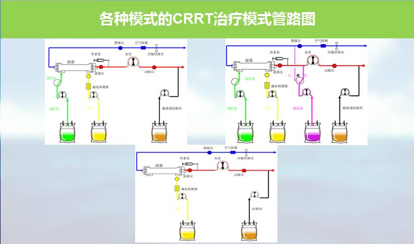 血液净化技术的基本原理_血液净化技术的互补性   血液净化技术在原有技术基础上不断发展和