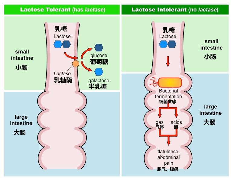 乳糖不耐症佔人口比例_乳糖不耐症大便照片