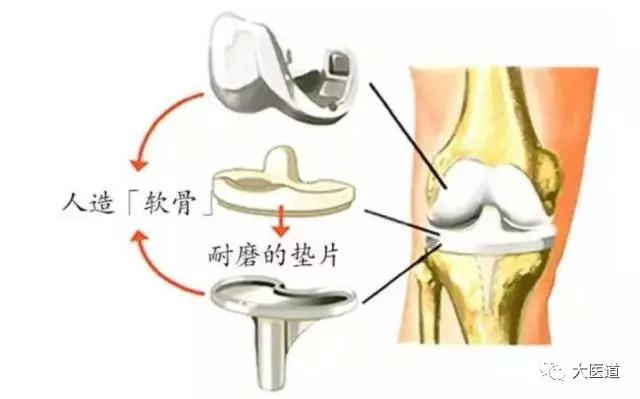 老人口里有痰怎么办_抱宝宝要多加注意 育儿专家 这几类人不要抱新生儿(2)