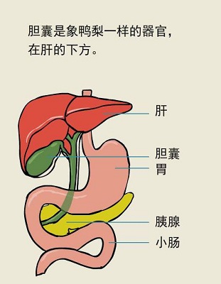 趣味解答:胆囊结石的前生后世