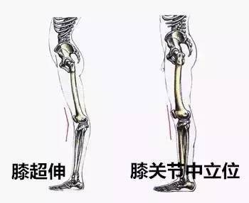 膝过伸时人体重心向后或向前倾斜,是导致异常步态的原因之一