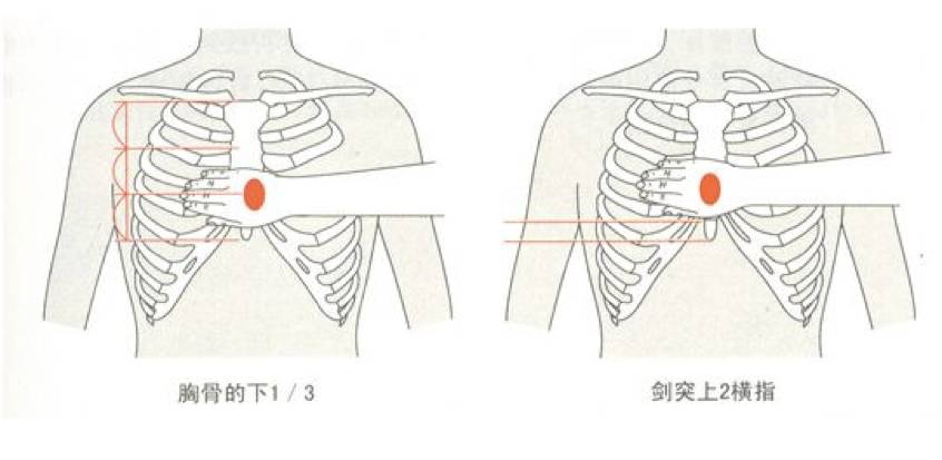 按压部位为胸骨中下段(男性可定位为双侧乳头连线的中点),按压深度为3