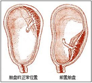 什么是胎盘?