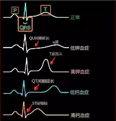 胸大的原理_俊美人台 小董 胸省的十大秘密