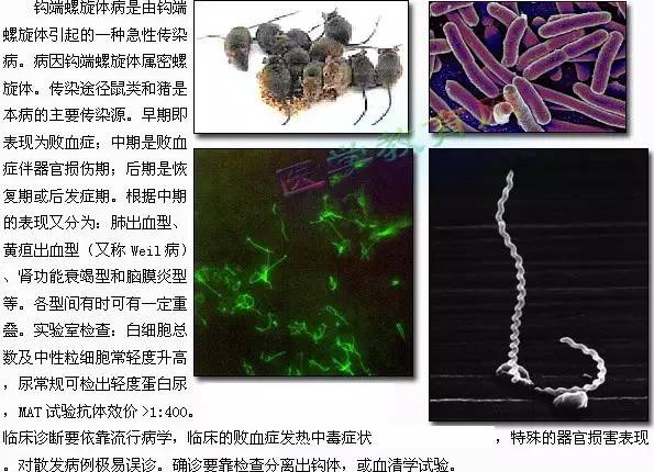 钩端螺旋体病