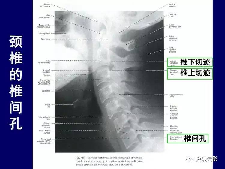 【骨肌组推荐】颈椎x线片阅读